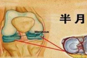 如何保护膝盖和半月板运动、伤害膝盖的习惯