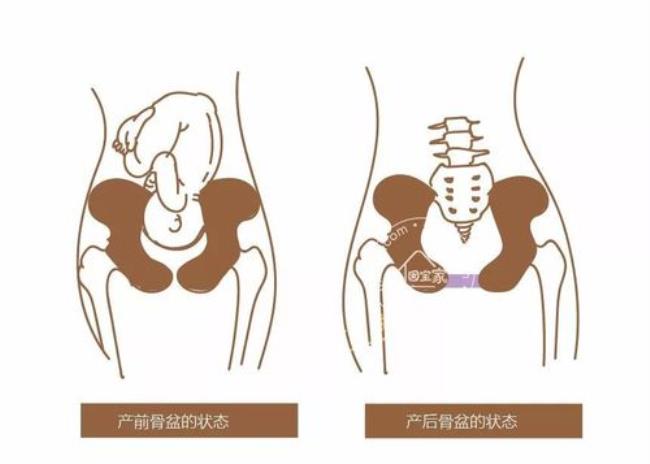 产后盆骨痛是怎么回事