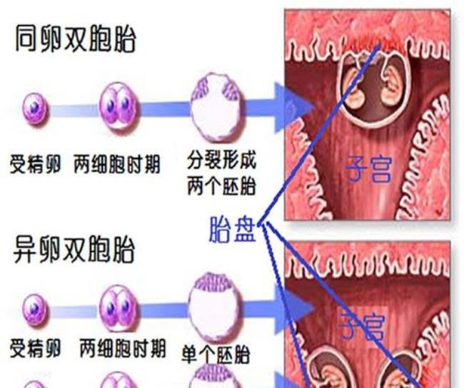 为什么双胞胎是旁系血亲