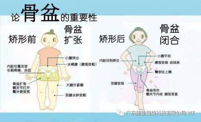 孕妇骨盆疼是怎么回事