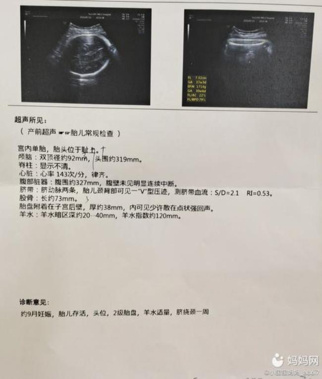 39周和40周宝宝的区别是什么