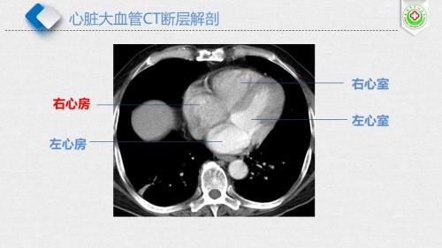 放射影像是什么