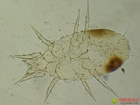 为什么显微镜拍螨虫要打马赛克