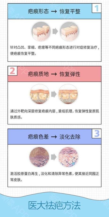 疤痕体质能打疤痕软化针吗