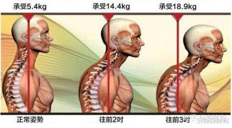 身体承受10个G的压力是什么感觉