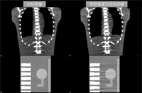ct重建技术有几种