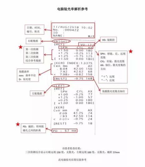 100度的验光数据是多少