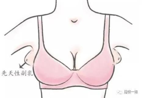 婚纱照副乳可以p掉么