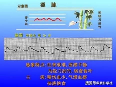 p脾虚的脉象