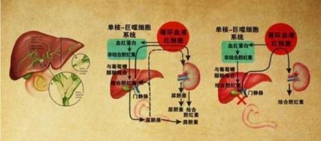 胆红素高有什么危害