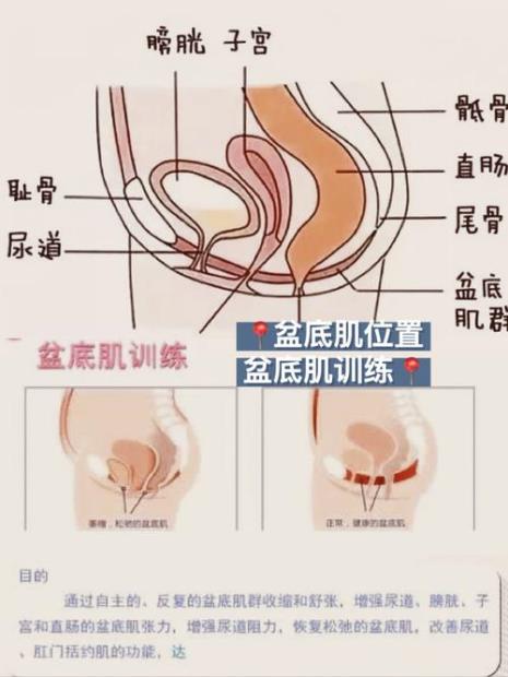 盆底肌产后多久能够恢复