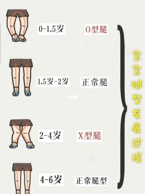 小孩腿有三个线正常嘛