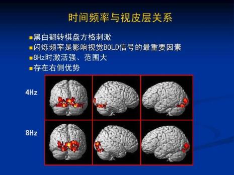 tms与fmri的区别