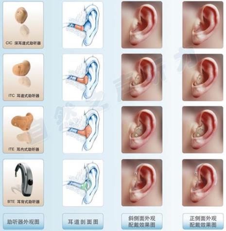 助听器六大品牌有哪些