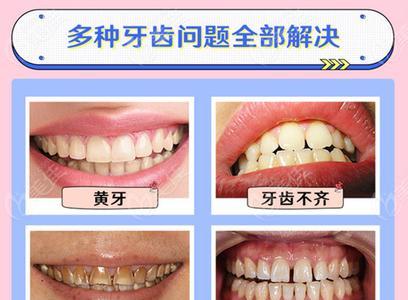 中医院做一棵牙齿要多少钱