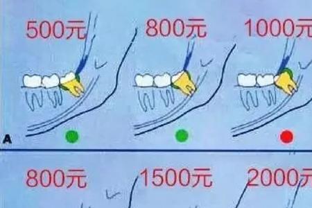 贫困户拔智齿能报销医保吗