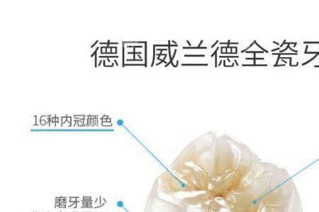 全瓷牙保质期内重新做收费吗