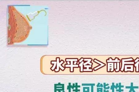 乳腺结节纵横比是什么意思