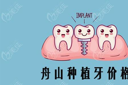种植牙的寿命和价格分别是多少