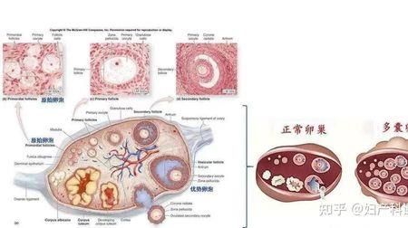 pro pcos与ultra pcos 的区别