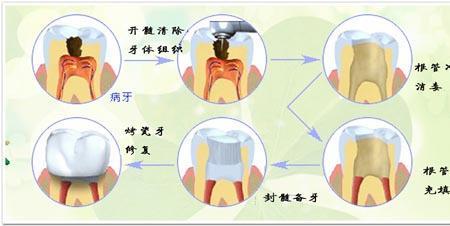 医保个人账户可以用来镶牙吗