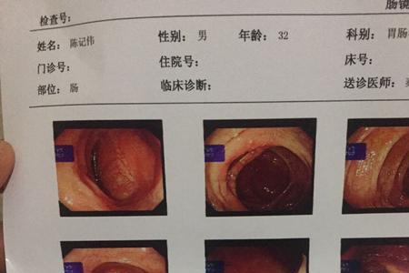 成都哪家医院可以做肠镜检查