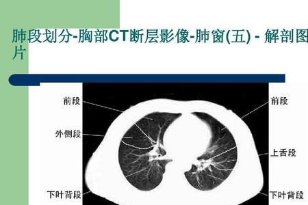 ct成像系统包括哪五大部分