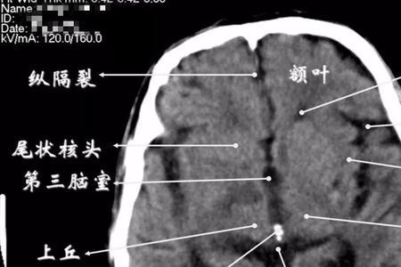 ct组成的三大系统