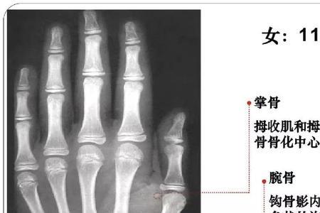 青春期男孩骨龄是几岁