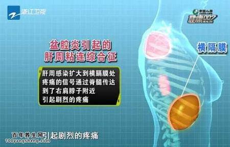 宫腔粘连商业险可以报吗