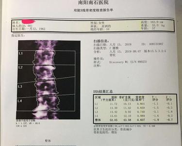 人骨头的密度