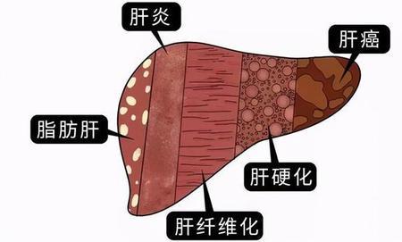 养肝的成语