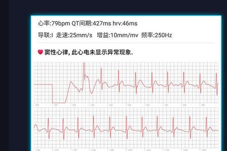 fmc btle是什么手环的蓝牙