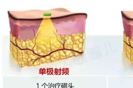 双极型与单极型区别