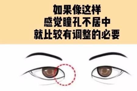 眼皮内眦赘皮怎么化妆