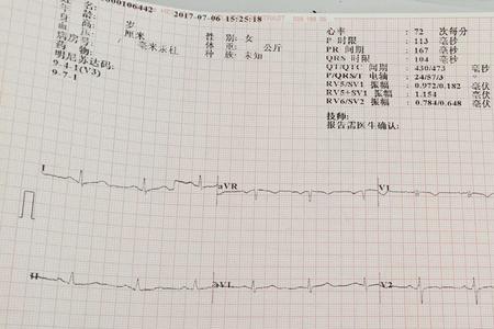 qtc间期怎么计算