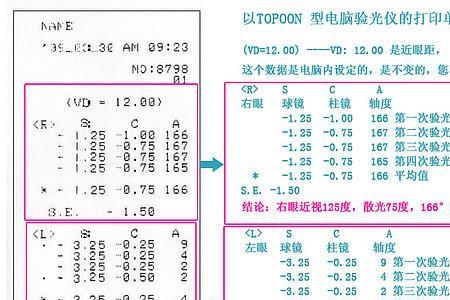 300度的验光轴位是多少