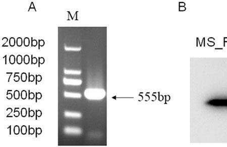 ms在生物上是什么意思