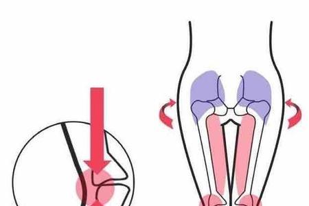 xo型腿鞋底哪侧磨损严重