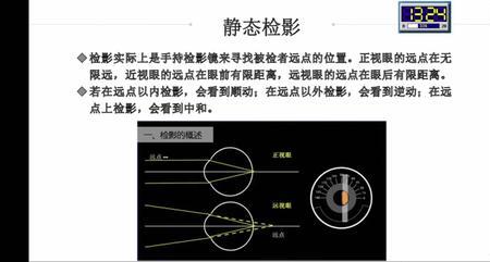 五轮验光法