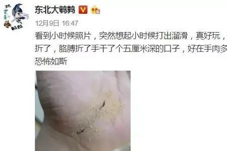 长的真滑溜什么意思