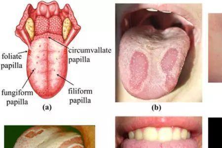 舌头形状代表什么意思