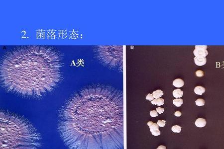 什么是真核细胞型微生物