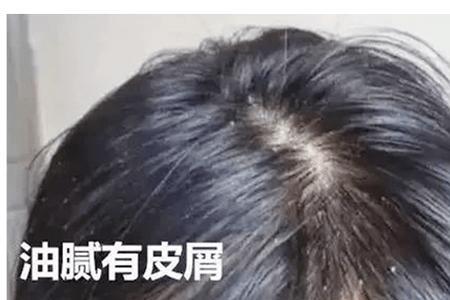 摩根烫洗头明显还是不洗头明显