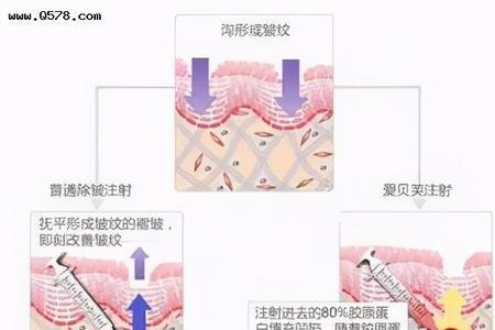 爱贝芙可以溶解吗