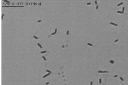 芽孢在显微镜下的形态