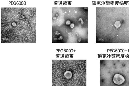 密度梯度离心法原理