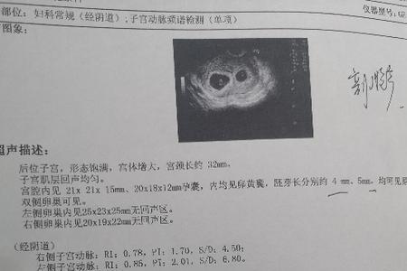 双胞胎宝宝四个月发育标准