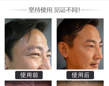 男士对抗皱纹需要哪几个化妆品