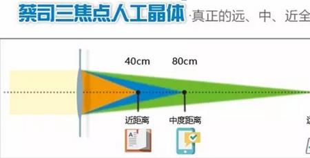 三焦点人工晶体哪个品牌最好